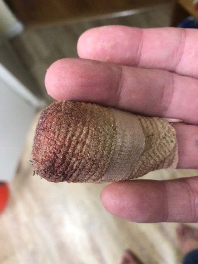 bandaged damaged finger